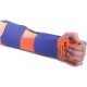 Attelle SAM Splint